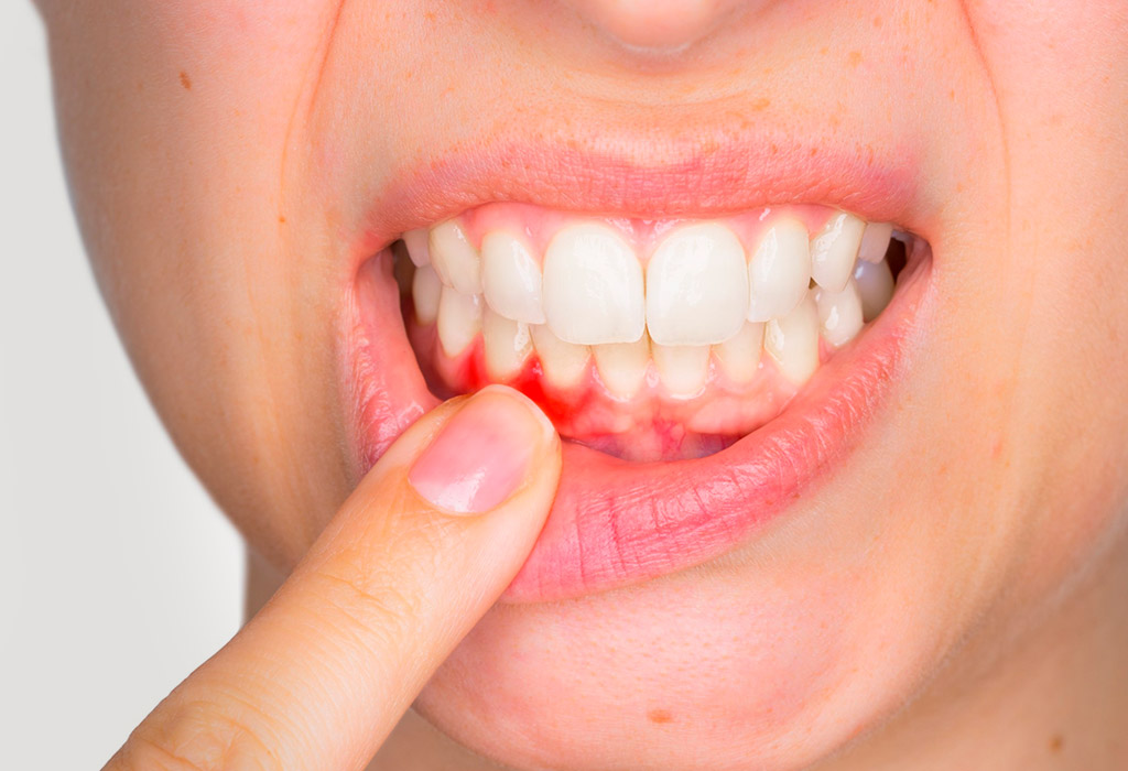 tratamientos periodontales en Getxo tratamientos periodontales en Getxo