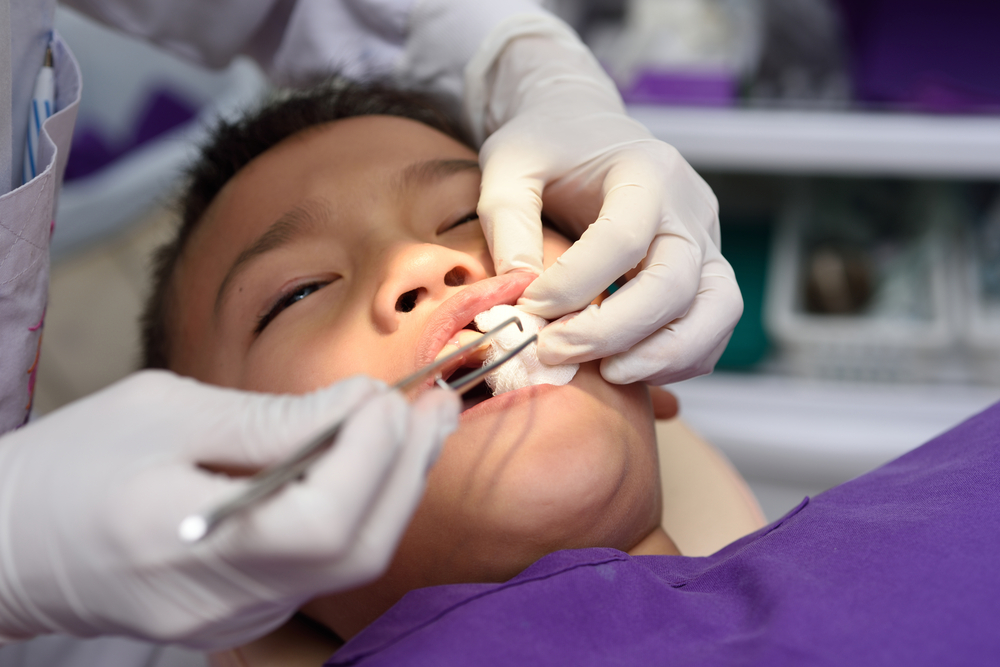 avulsión dental niños