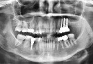 tecnología dental en Getxo