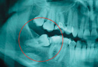 tecnología dental en Getxo